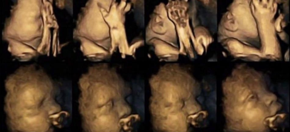 Ένα έμβρυο ενοχλείται από το κάπνισμα και το δείχνει