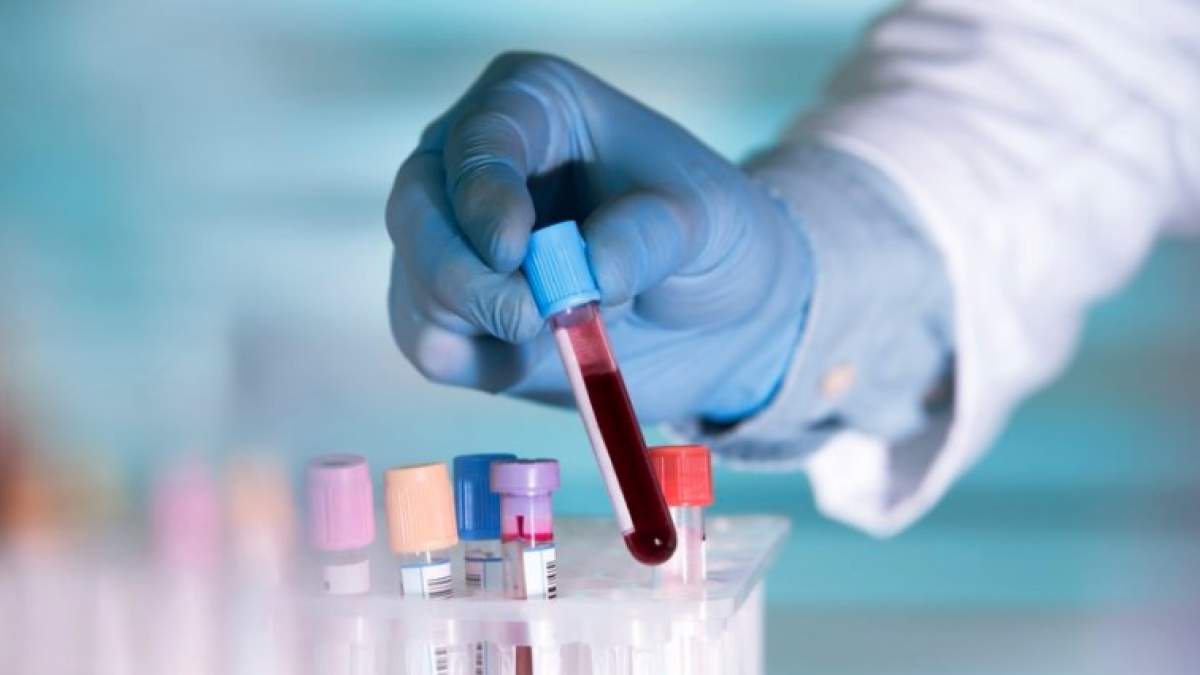Νέο τεστ αίματος ανιχνεύει οποιονδήποτε καρκίνο μέσα σε δέκα λεπτά